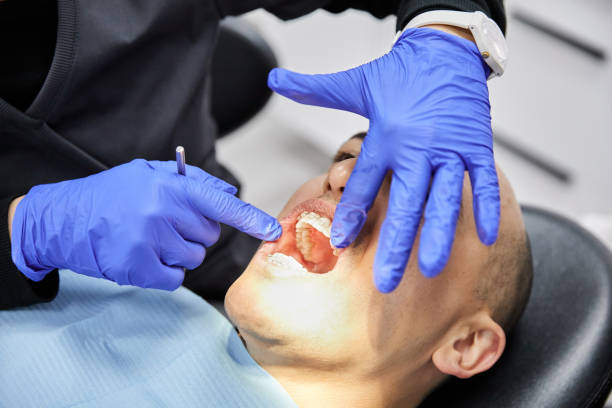 Best Broken or Chipped Tooth Repair in Danville, PA